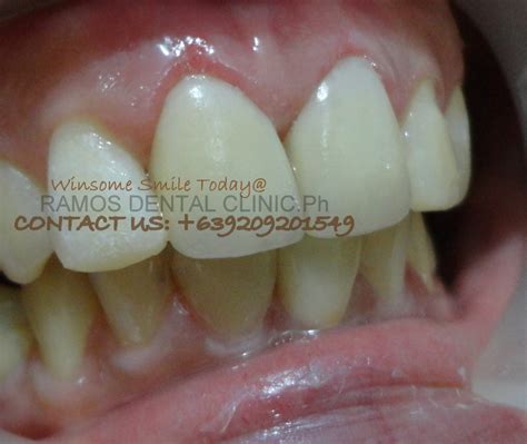 Winsome Smile Today@RAMOS DENTAL CLINIC.